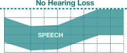 Normal hearing Chart